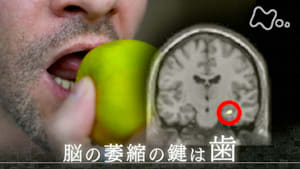 ヒューマニエンス　４０億年のたくらみ　“歯”　進化を続ける人体の先兵