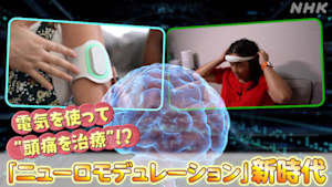 サイエンスＺＥＲＯ　電気を使って“頭痛治療”！？ニューロモデュレーション新時代